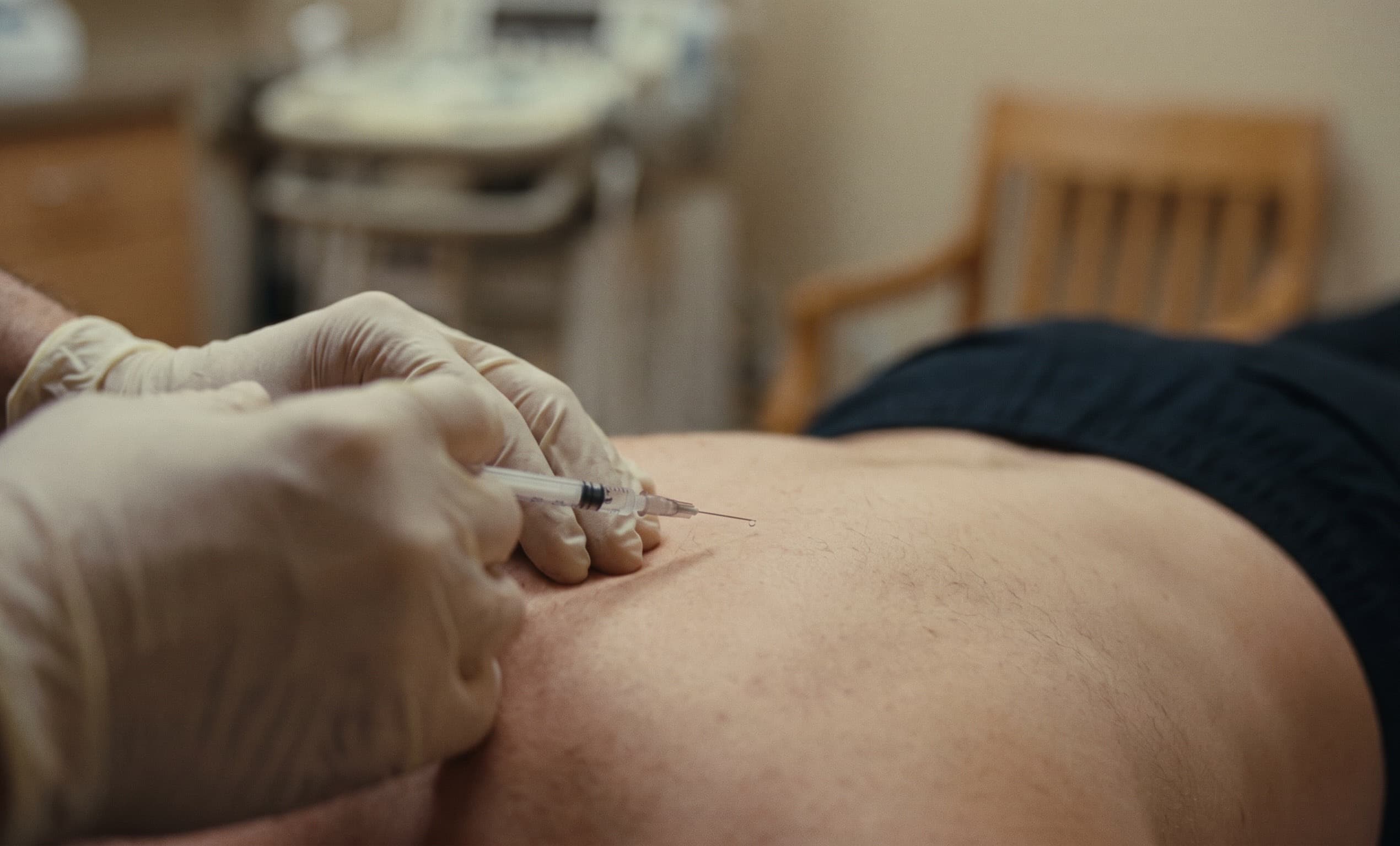 Microinjeção de mesoterapia nas costas