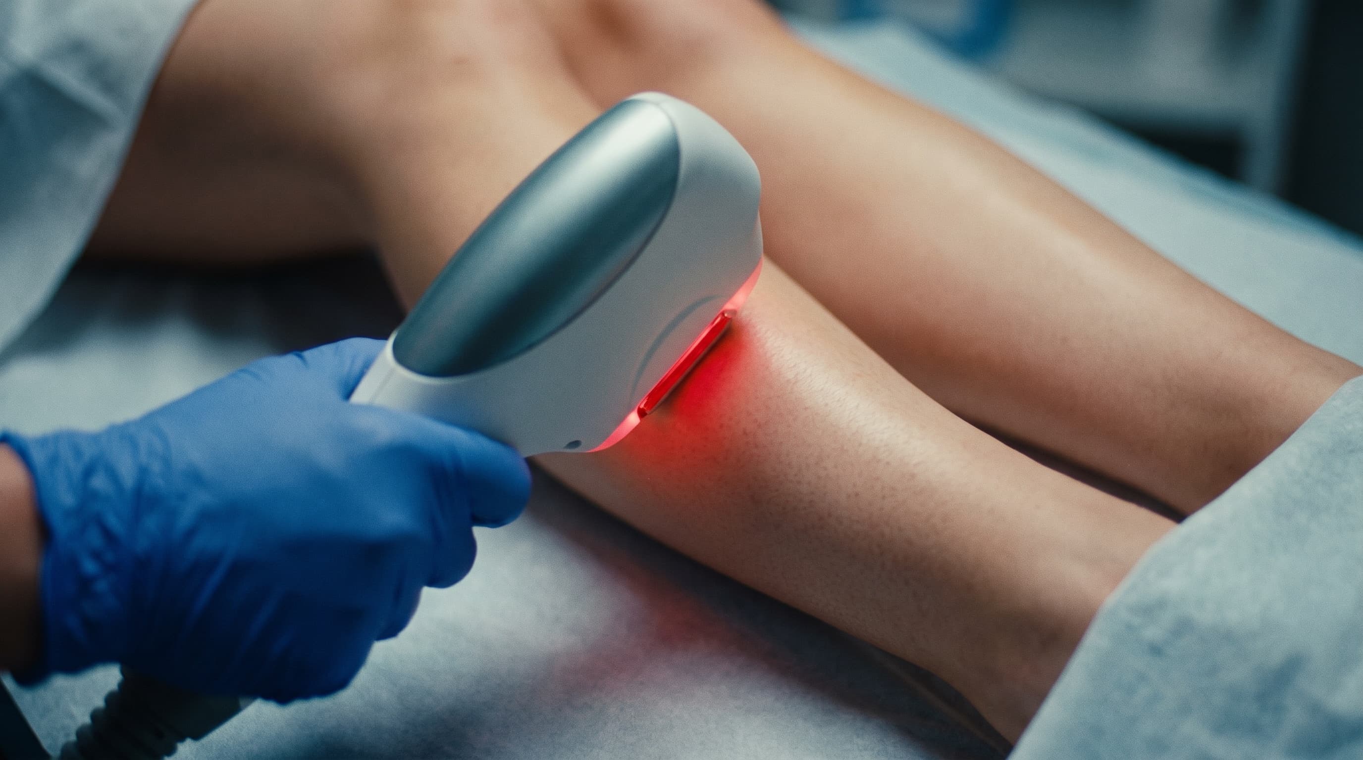 Depilação a laser díodo na perna